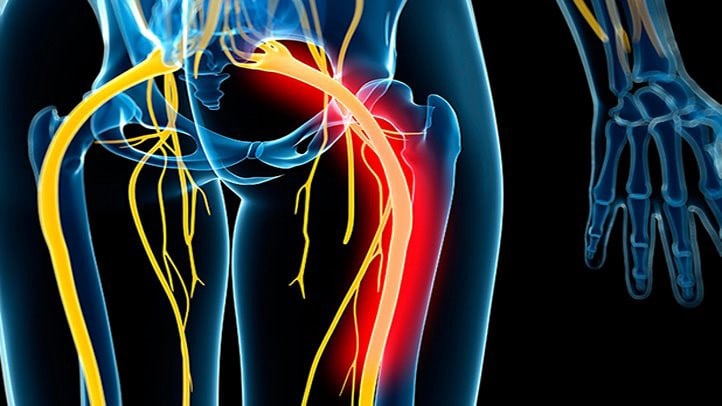 A person's sciatic nerve experiences pain relief through manual therapy.