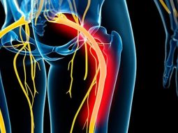 A person's sciatic nerve experiences pain relief through manual therapy.