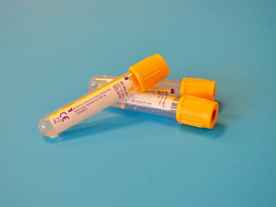 3 tubes that are used to collect blood for labwork