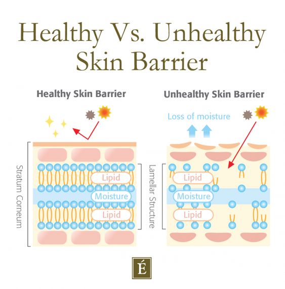 What a healthy skin barrier looks like vs a damaged skin barrier