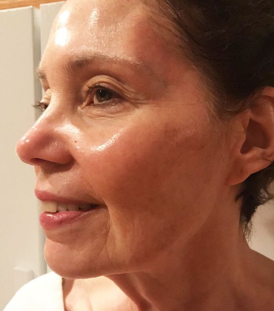 The best retinoids for anti ageing