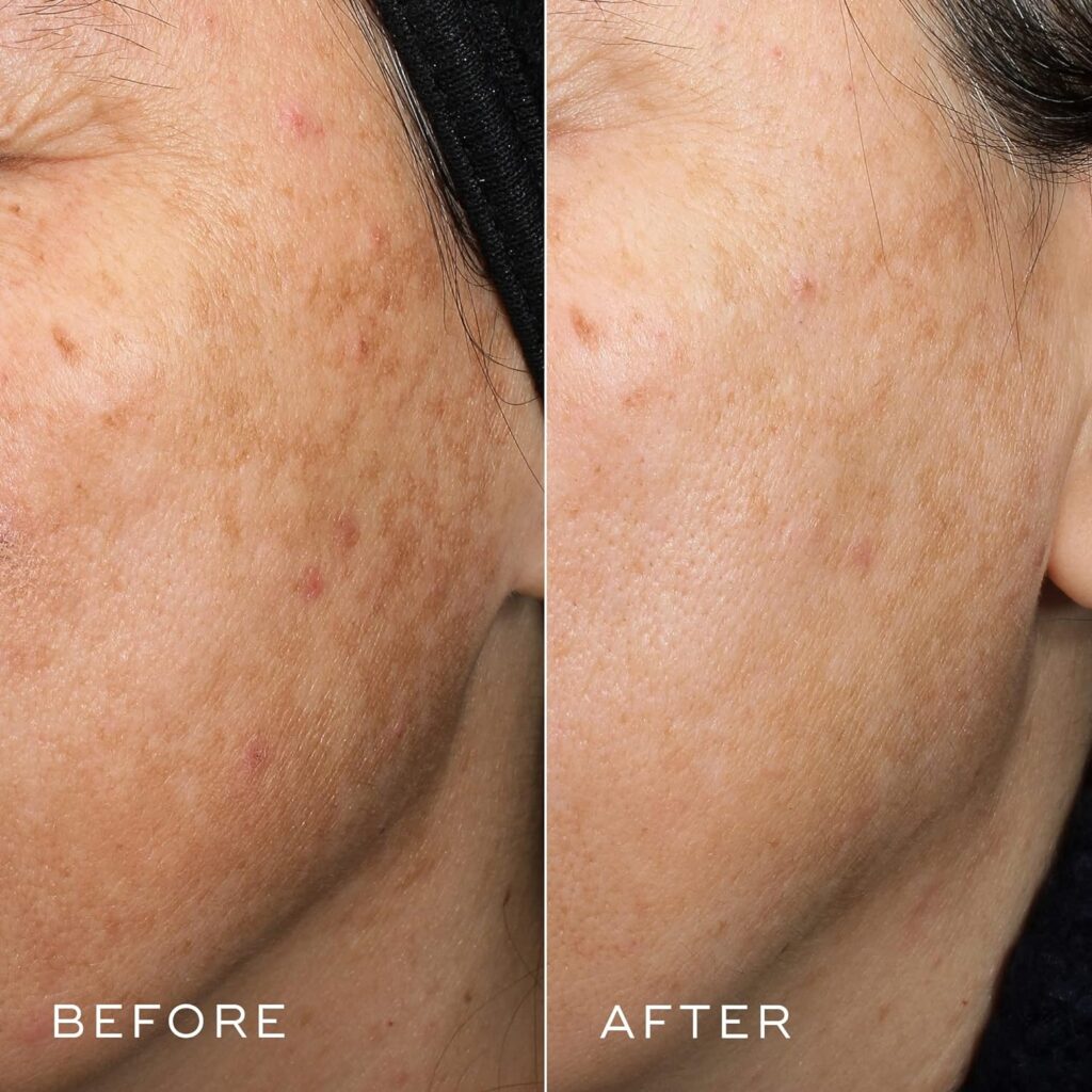 Medik8 Crystal Retinal before vs after
