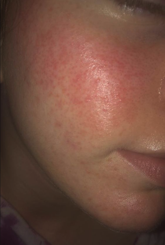 Best Korean Moisturizers for sensitive skin types