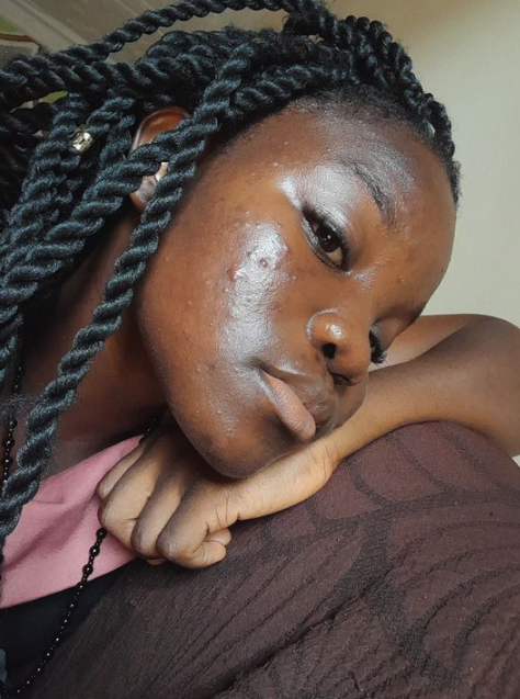 Korean moisturisers for hormonal acne