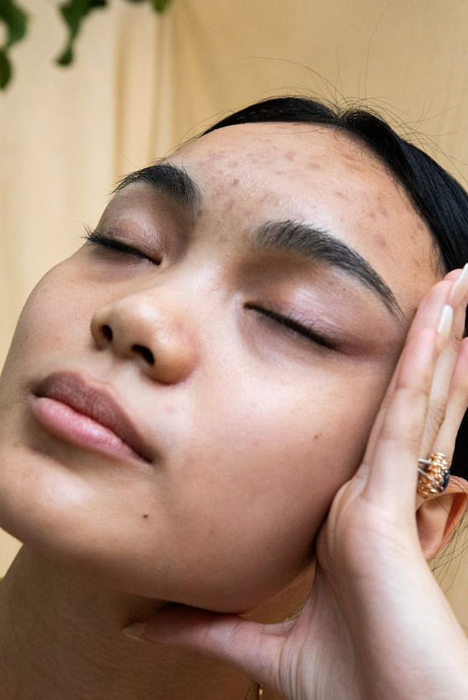 The 11 best ingredients to fade acne scars in 2025