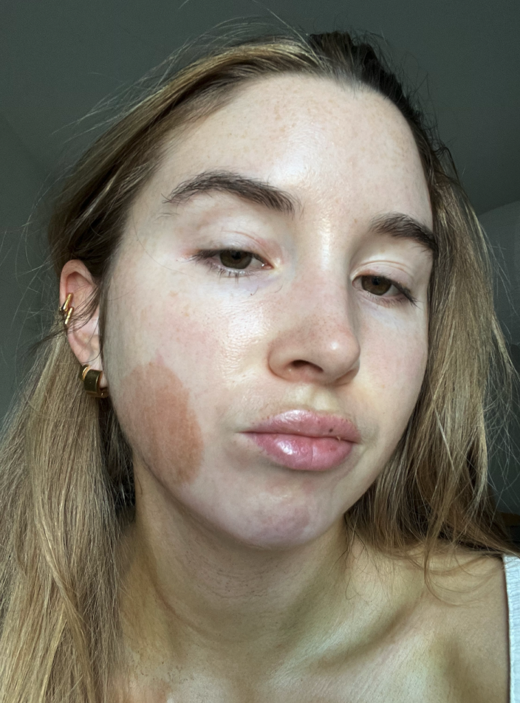 Spray tan mistakes