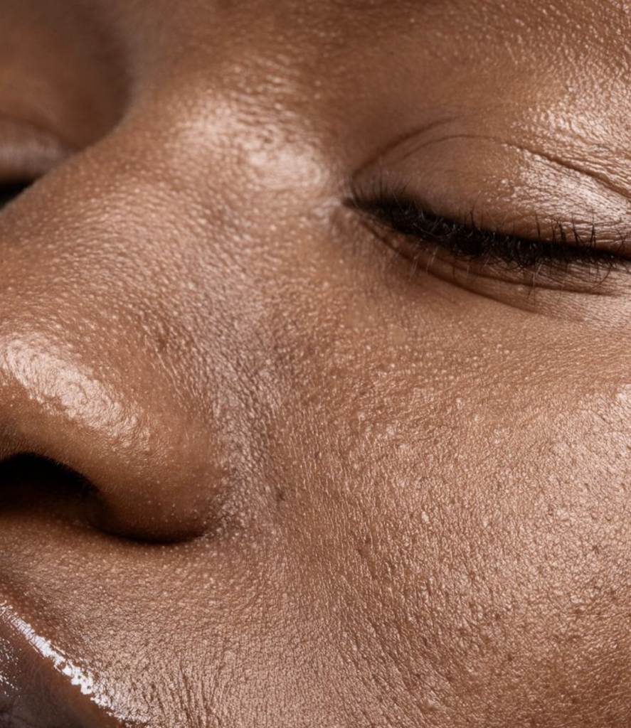 Is tretinoin making eye wrinkles worse Is tretinoin making eye wrinkles worse?