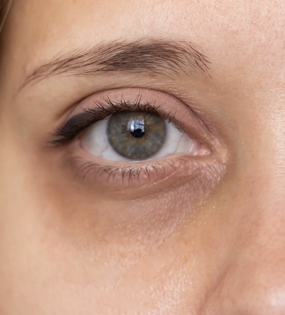 best eye cream for dark circles best eye cream for dark circles