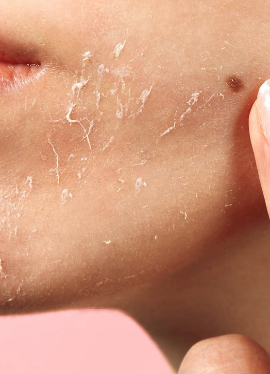 Should you use an exfoliating cleanser with tretinoin?