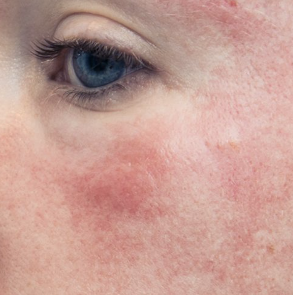 Can I use retinol and tretinoin together?