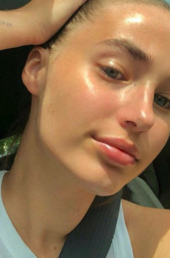 What is chemical exfoliation?