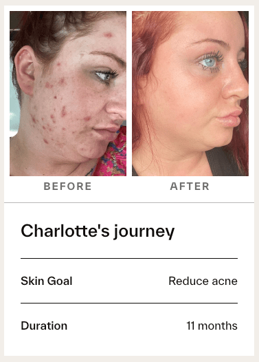 Dermatica vs Skin and Me