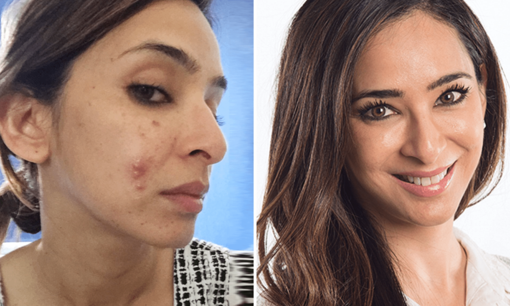 Best dermatologists in London