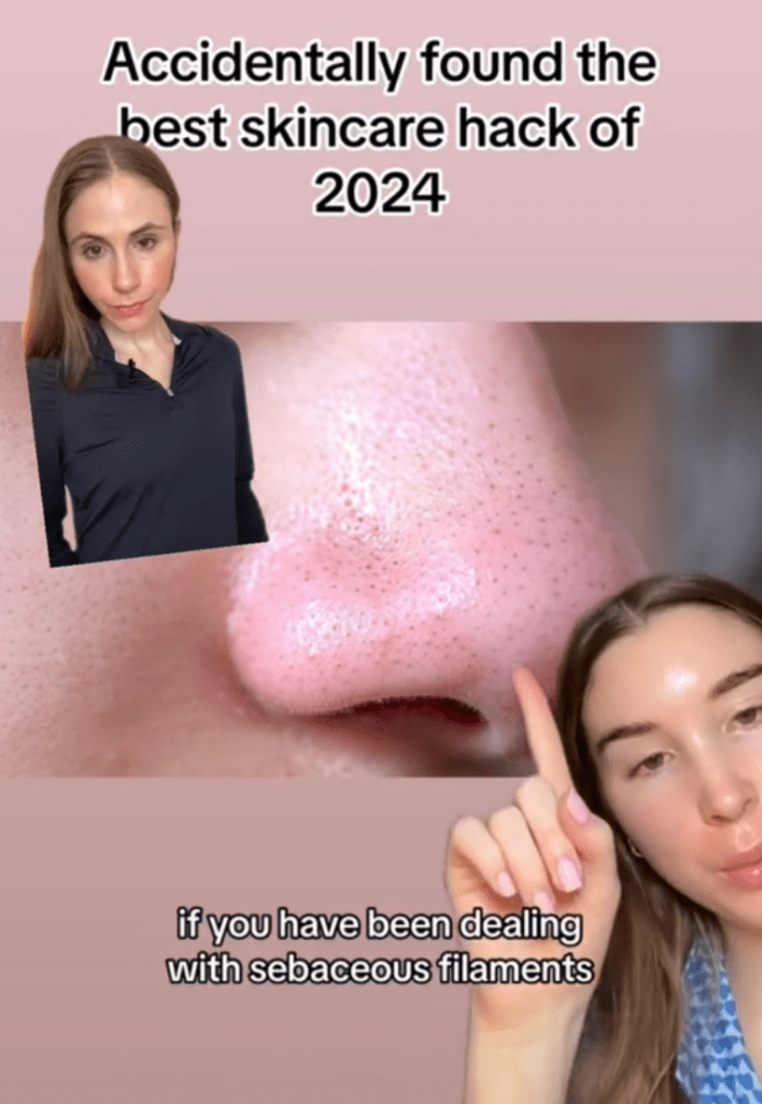 Sebaceous filaments hack with cicaplast baume