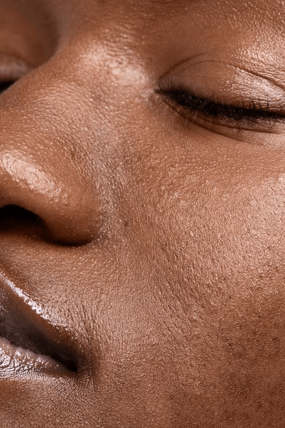 Best Korean skincare for acne: moisturiser