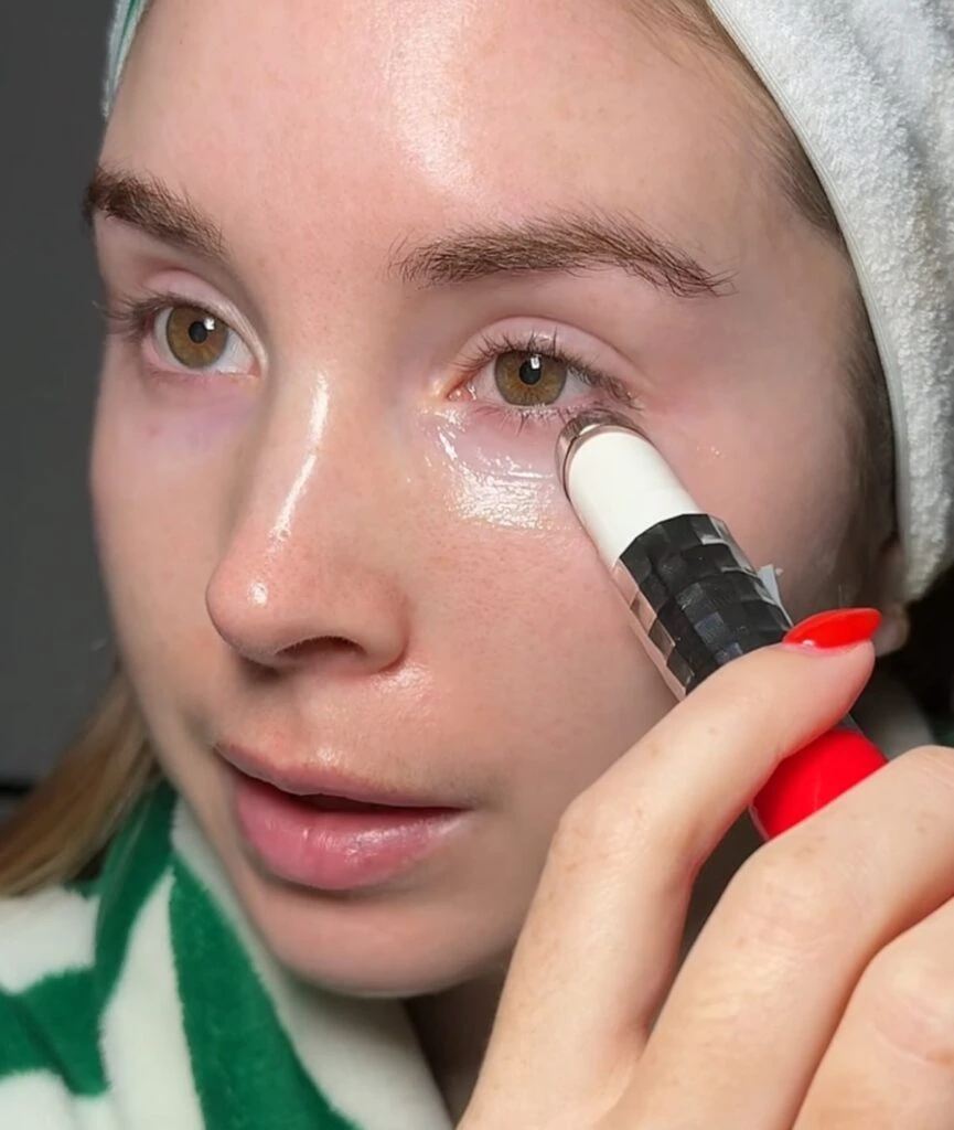 Does retinol get rid of freckles? My experience