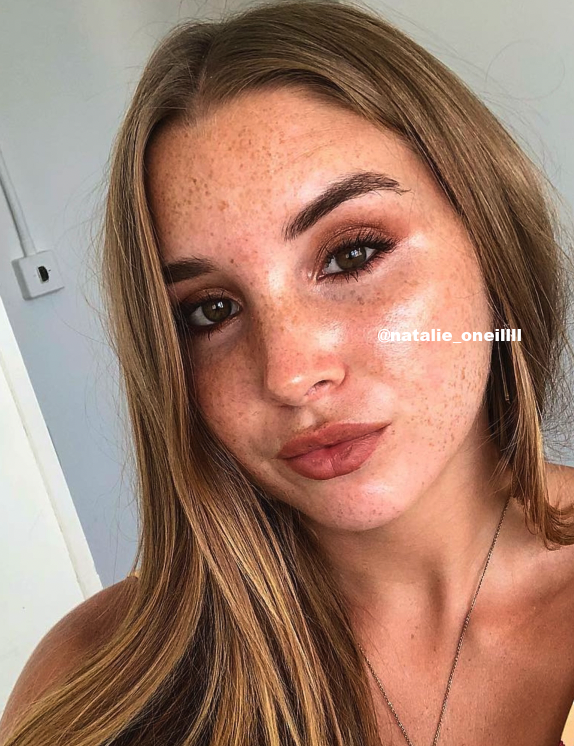 Does retinol get rid of freckles? My experience