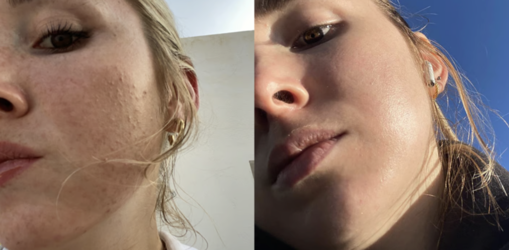 How to Use Retinol for Beginners: Step-by-Step Guide