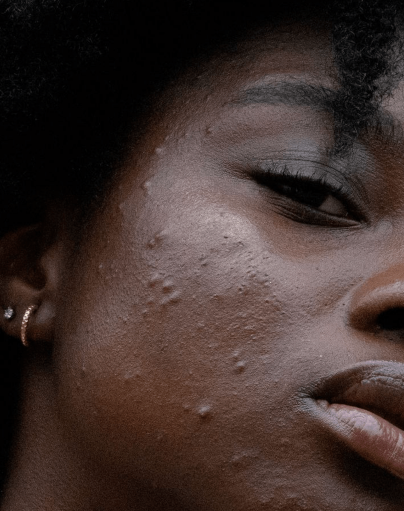 How often to use retinol for beginners