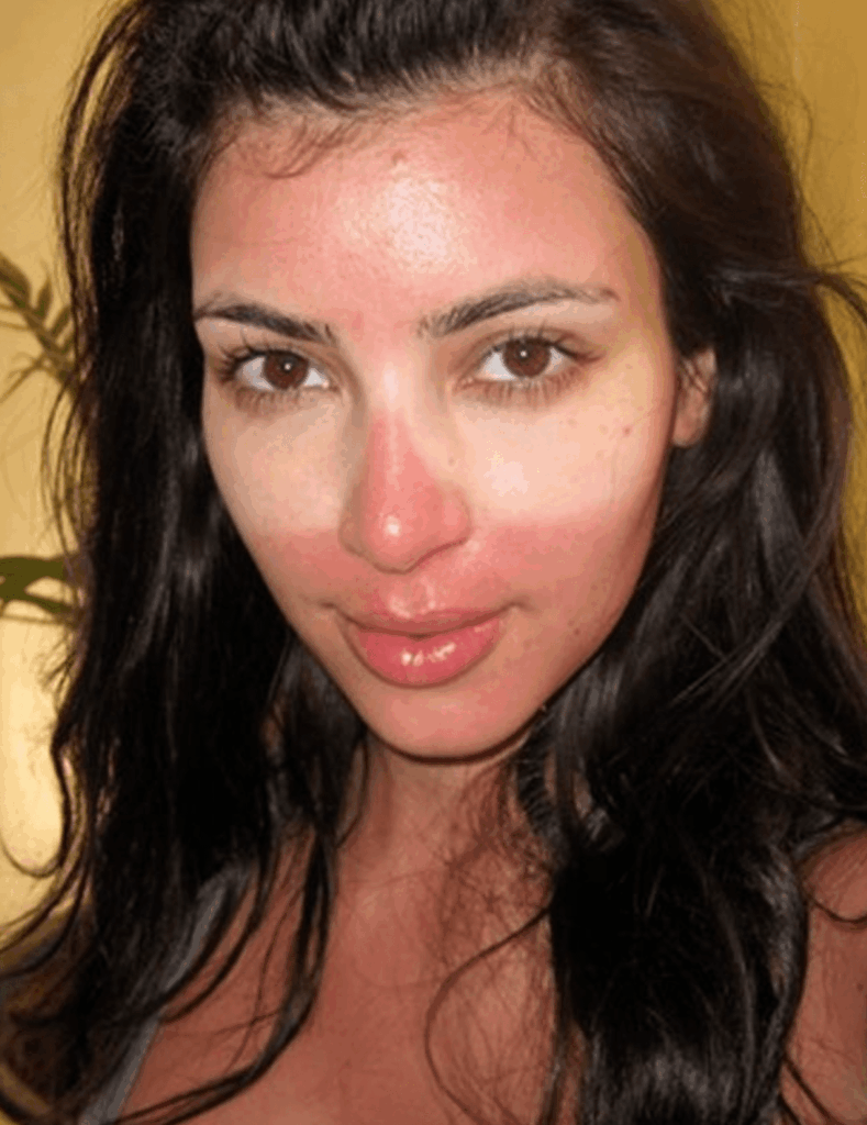 Can you get sunburn on a cloudy day? UV myths & truths