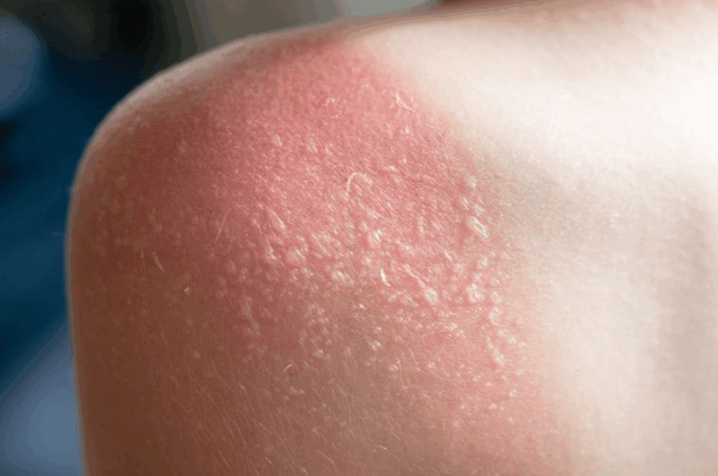 Do clouds stop you from tanning?