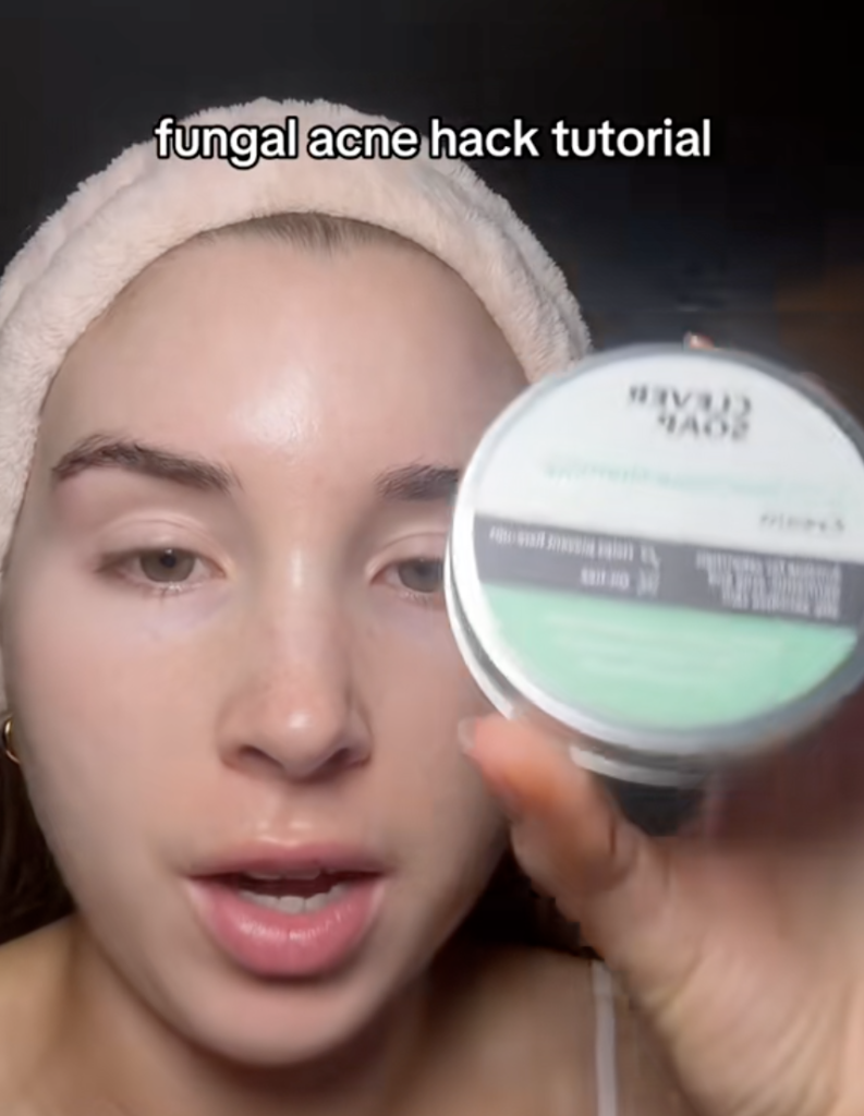 fungal acne hack tutorial fungal acne hack tutorial