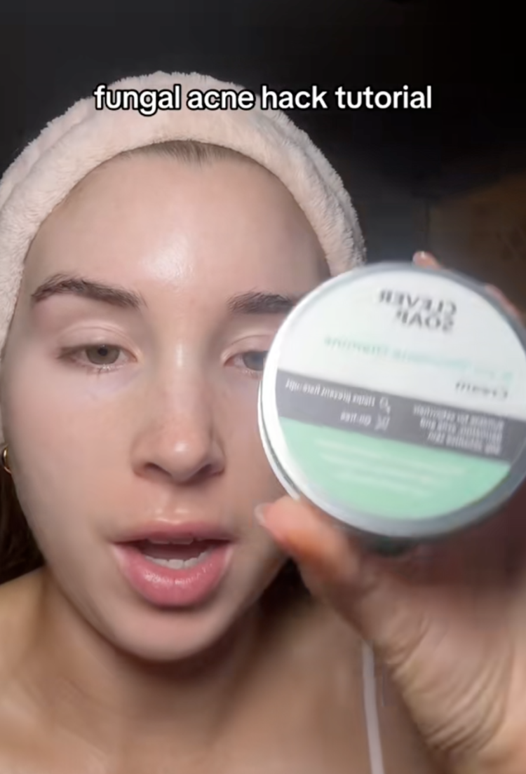 How to get rid of fungal acne on forehead