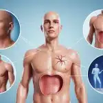 Éventration abdominale, signes d’urgence et chirurgie