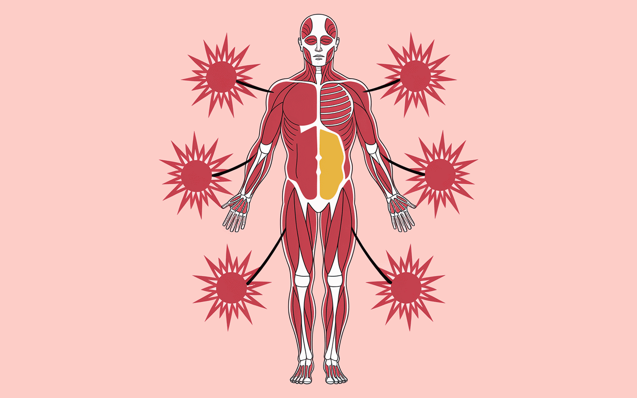 Power snatches groupes musculaires schéma