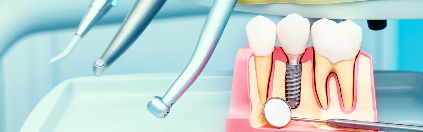 Dentista che effettua una devitalizzazione su un paziente