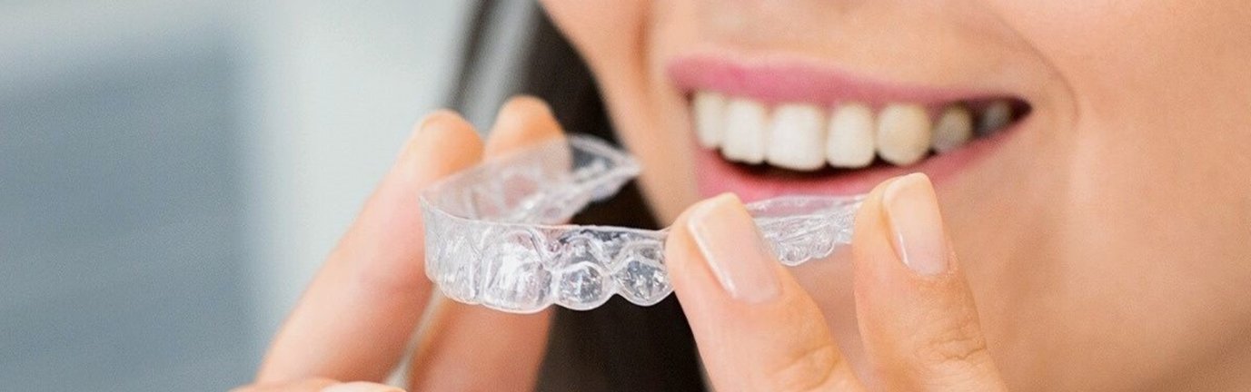 Donna che tiene in mano apparecchio ortodontico trasparente