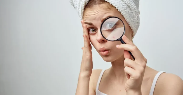 shocked woman with rash using magnifying glass to look at skincare ingredients
