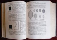 Anatomic Pathology Antique Book Two Vol Medicine Hirschfeld - Image 3