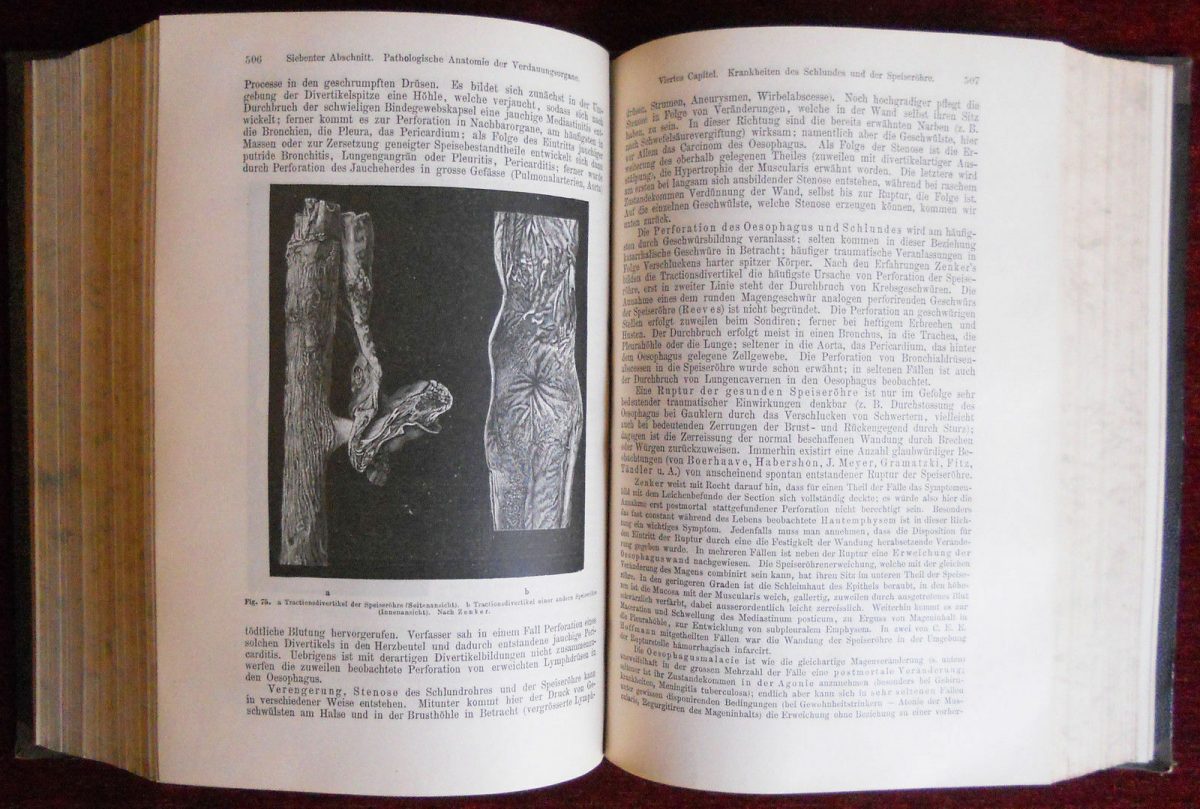 Anatomic Pathology Antique Book Two Vol Medicine Hirschfeld - Image 4