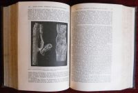 Anatomic Pathology Antique Book Two Vol Medicine Hirschfeld - Image 4