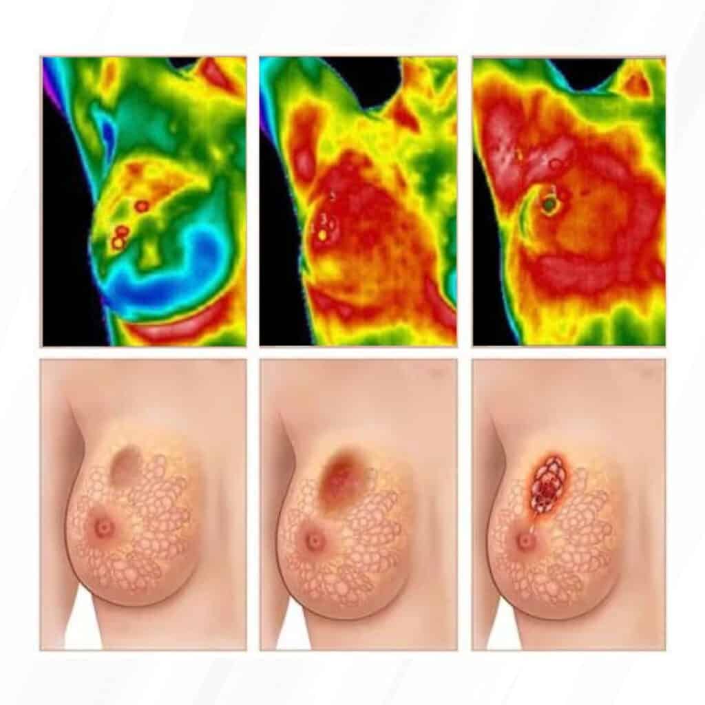 Total Wellness Thermography Images