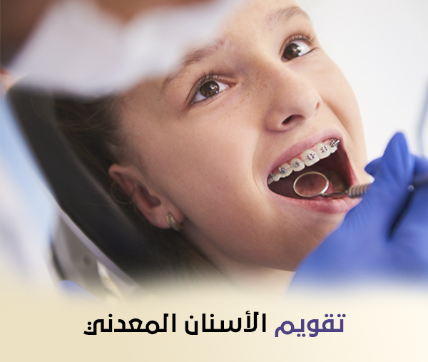 التقويم المعدني