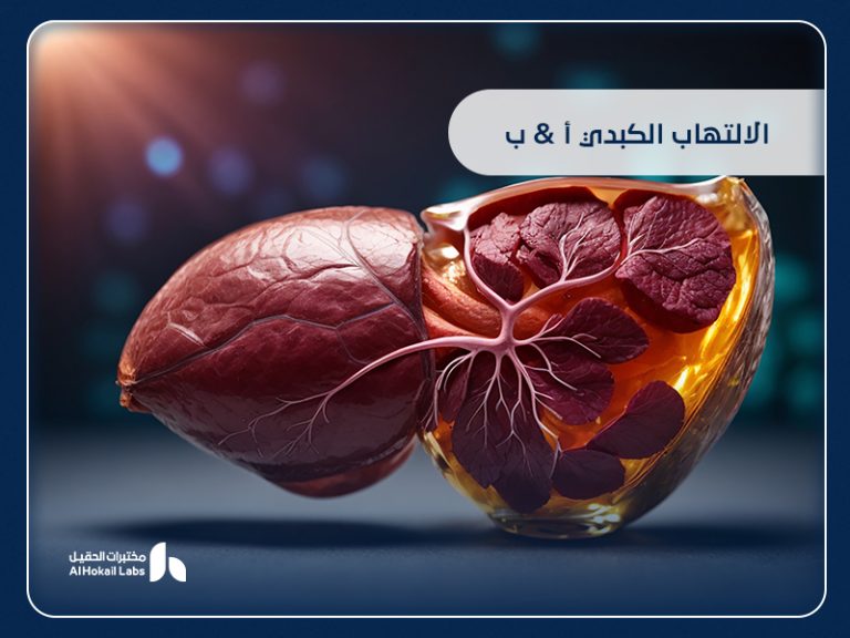 الالتهاب الكبدي A & B: الفيروسات الأكثر انتشارًا وكيفية الوقاية منها