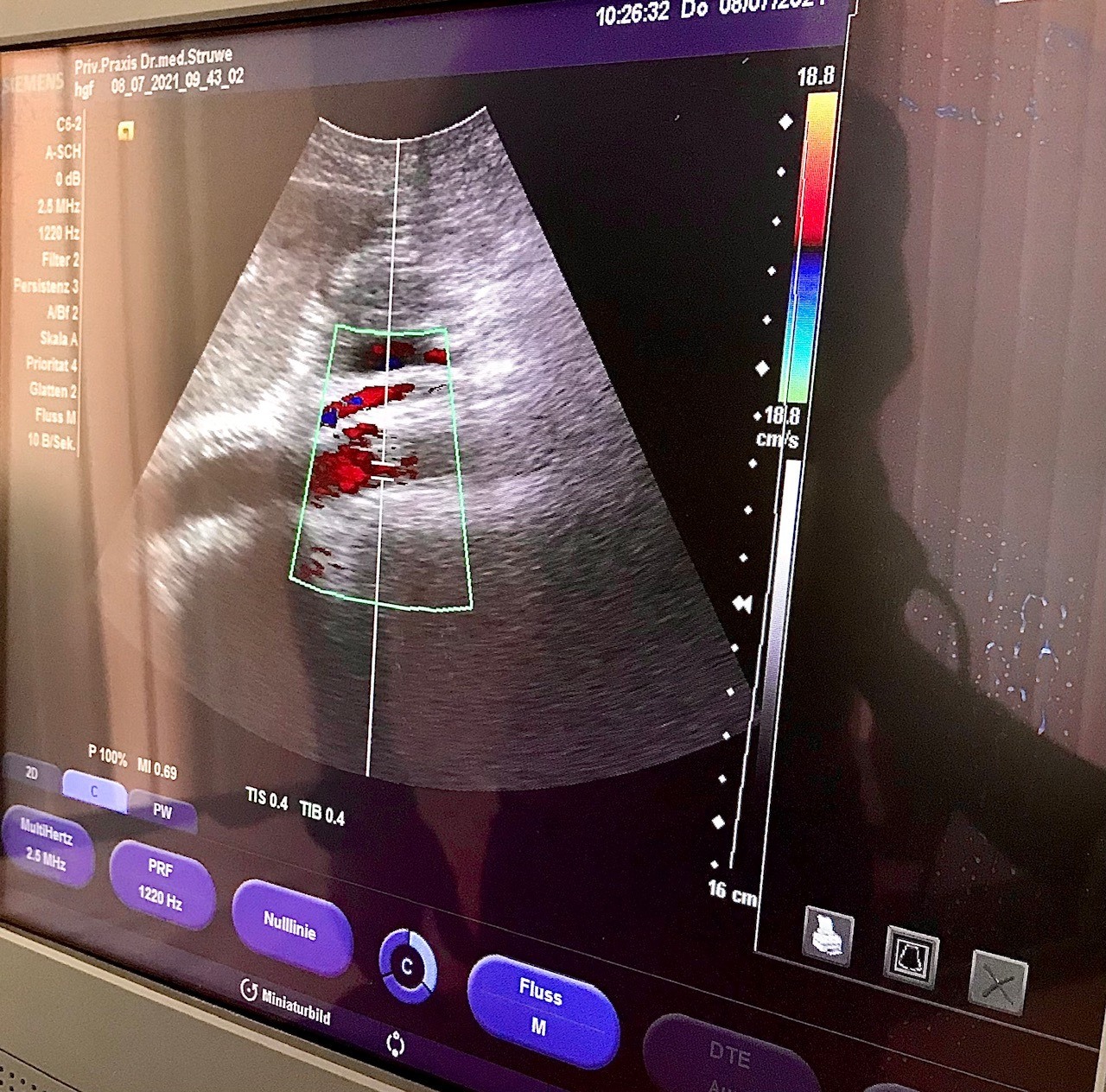 Herzultraschall beim Sportler-Check-Up - Dr. Otto Struwe & SCHORK Sports, Freinsheim