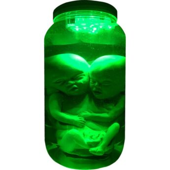 Formaldehyde Skin Siamese Twin Fetus Baby Fetal Specimen