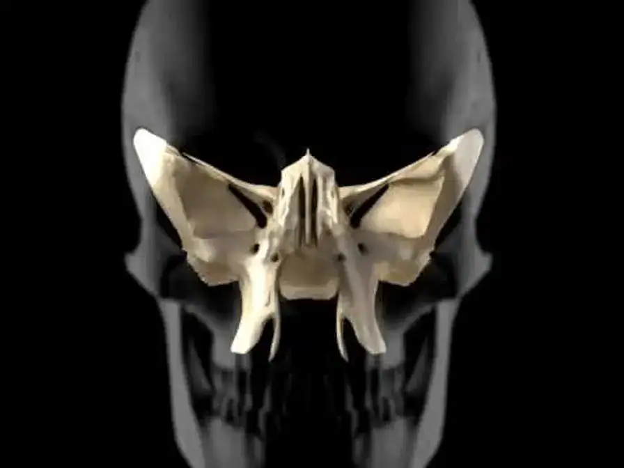 Skull with nasal cavity and sinus bones, emphasizing facial anatomy and structure.