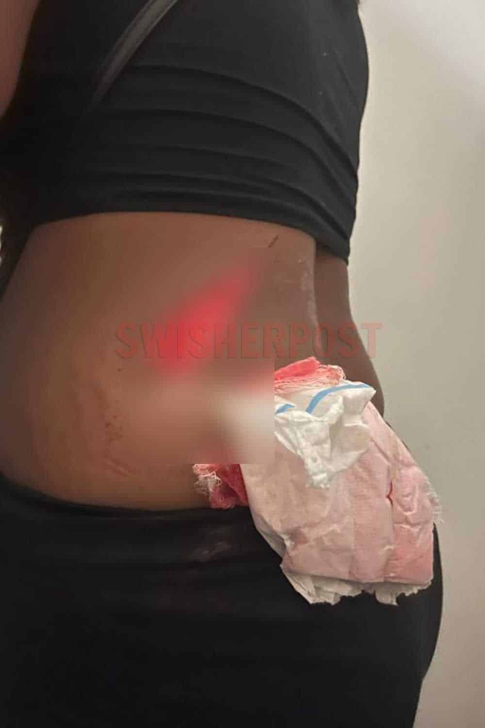 bolt South Africa stabbing silu daniso Cape Town video injury 1