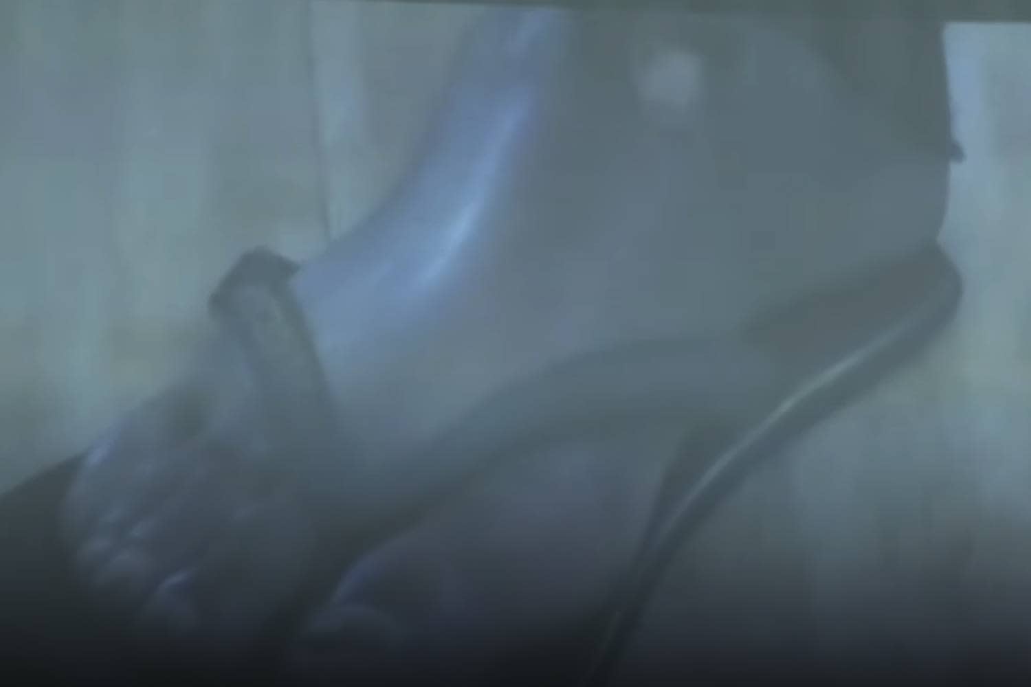 Jacquen Appollis foot