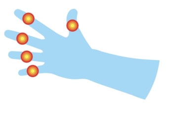 SZÓSZÁTYÁR NÖVÉNYEK