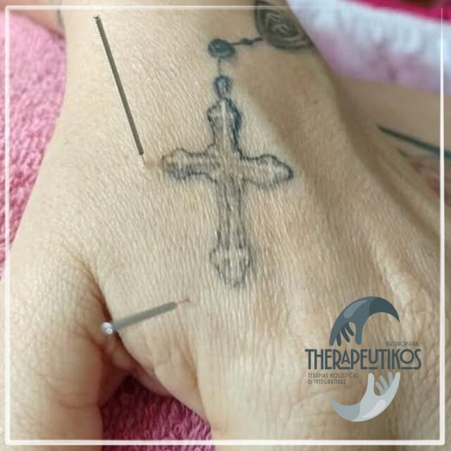 Dor? A Acupuntura oferece alívio rápido!⚡

Com o Acupunturista e Terapeuta Holístico Alex Costa, seu tratamento em Itaipava vai além:

Técnicas Integradas: Acupuntura + Massagem + Ventosas + Guasha + Auriculoterapia (aplicadas de acordo com as necessidades individuais e sem custos adicionais). 

Confiança: 20 anos de experiência e avaliação 5 estrelas no Google. ⭐⭐⭐⭐⭐

Tire suas dúvidas pelo WhatsApp (24) 99847-3406 ou no Direct.