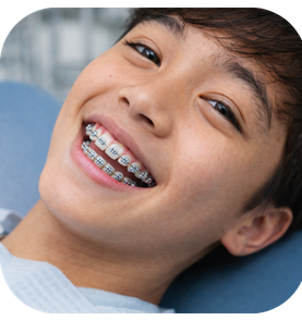 Pasang Behel Metal Pria di Klinik Gigi Jakarta