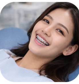 Pasang behel sapphire di klinik gigi Jakarta dengan dokter berpengalaman, hasil rapi dan transparan, cocok untuk remaja dan dewasa.