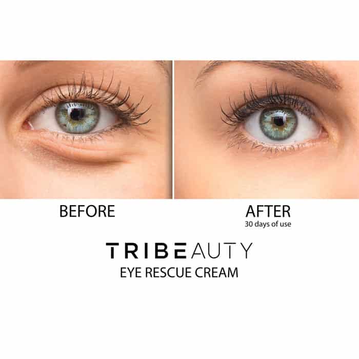 TRIBEAUTY Eye Rescue Cream - Before and After