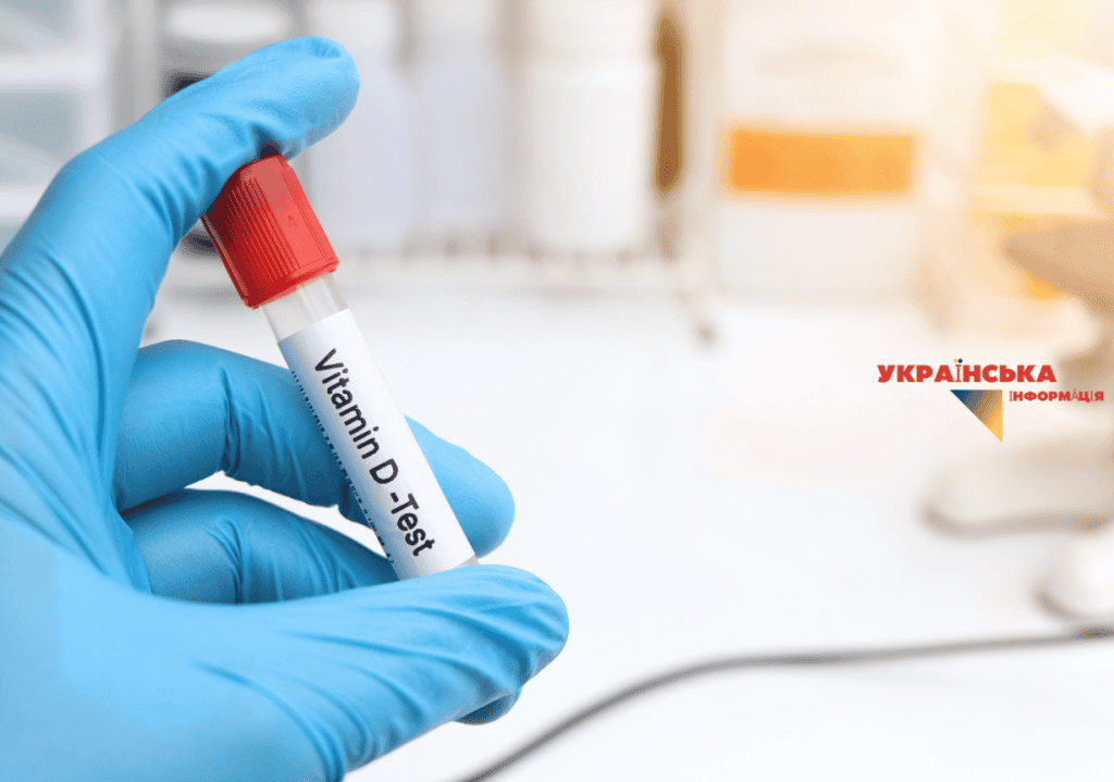 Blood test for 25(OH)D. Source: ARC Medical