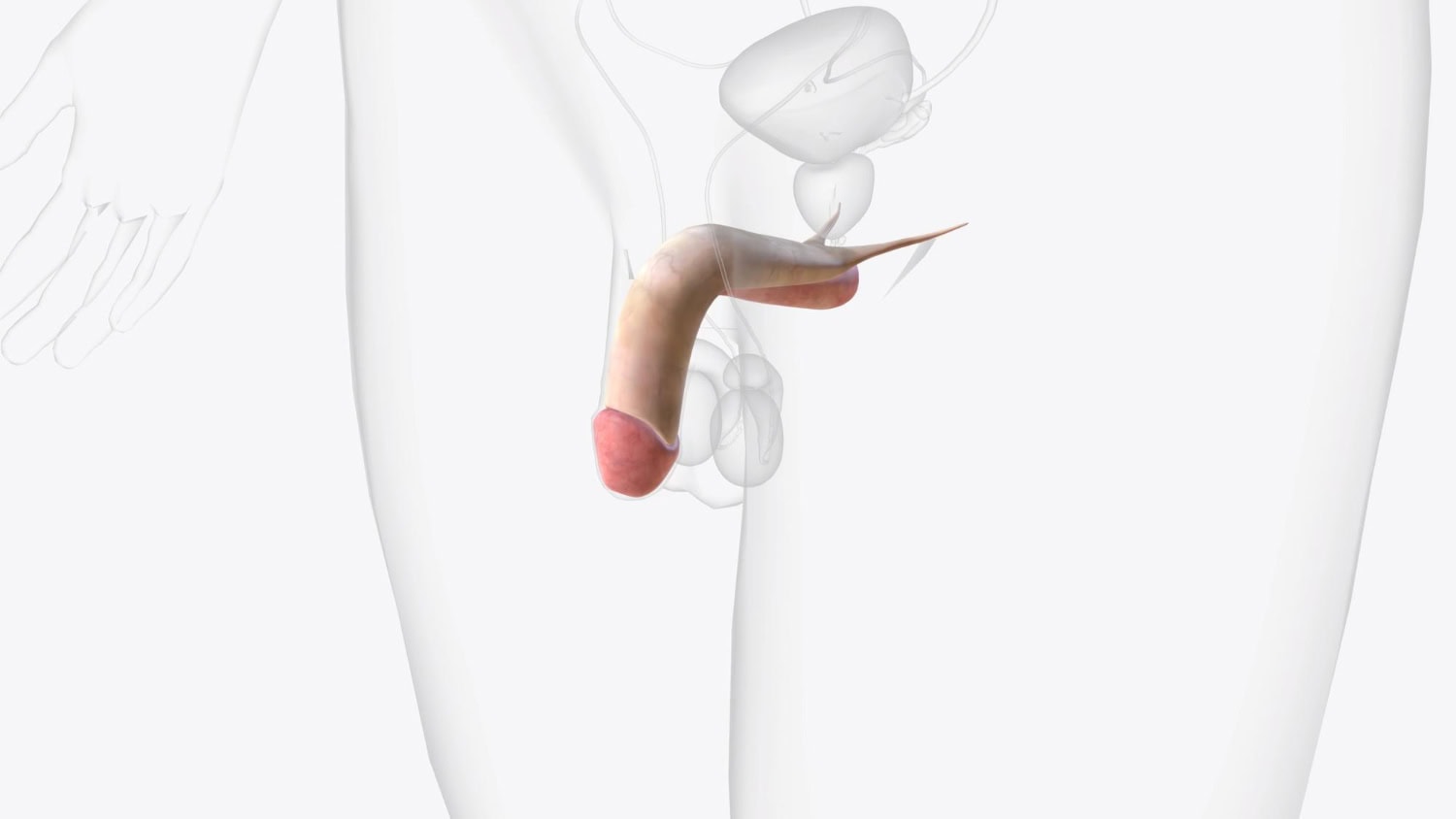 How to get rid of curvature